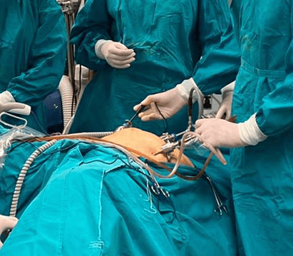 Chirurgia laparoscopica (endoscopica)